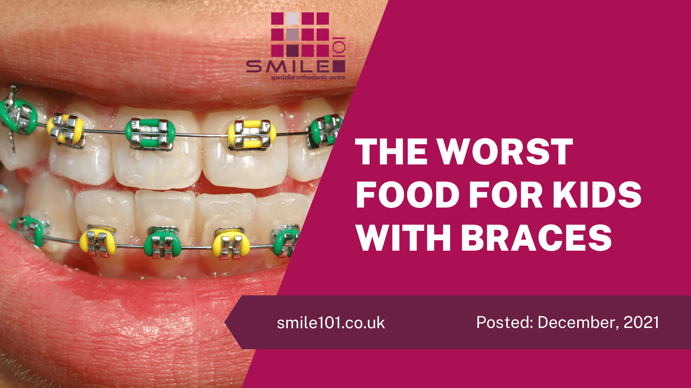The Worst Food For Kids With Braces