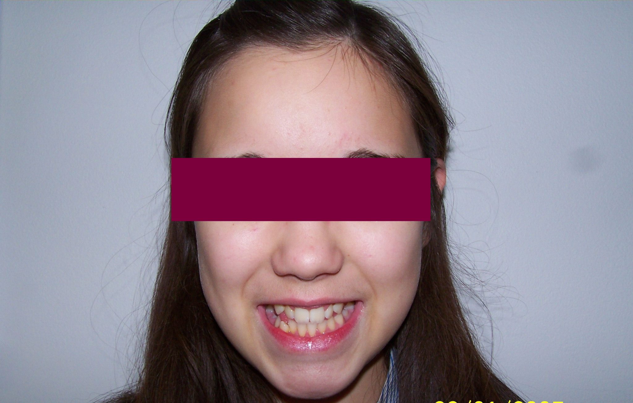 Before image