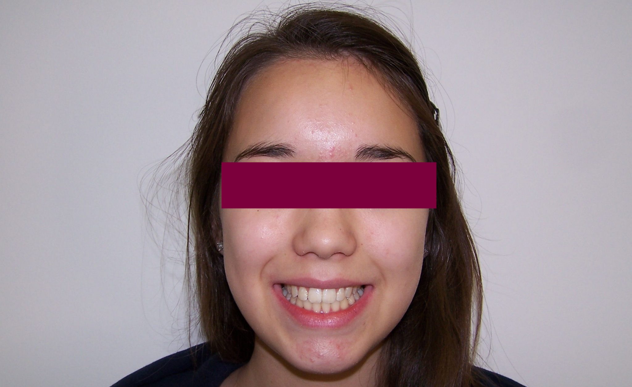 After image