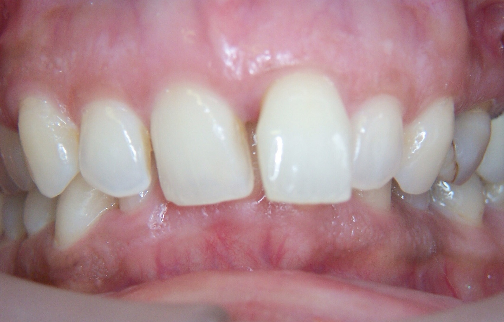 Before image