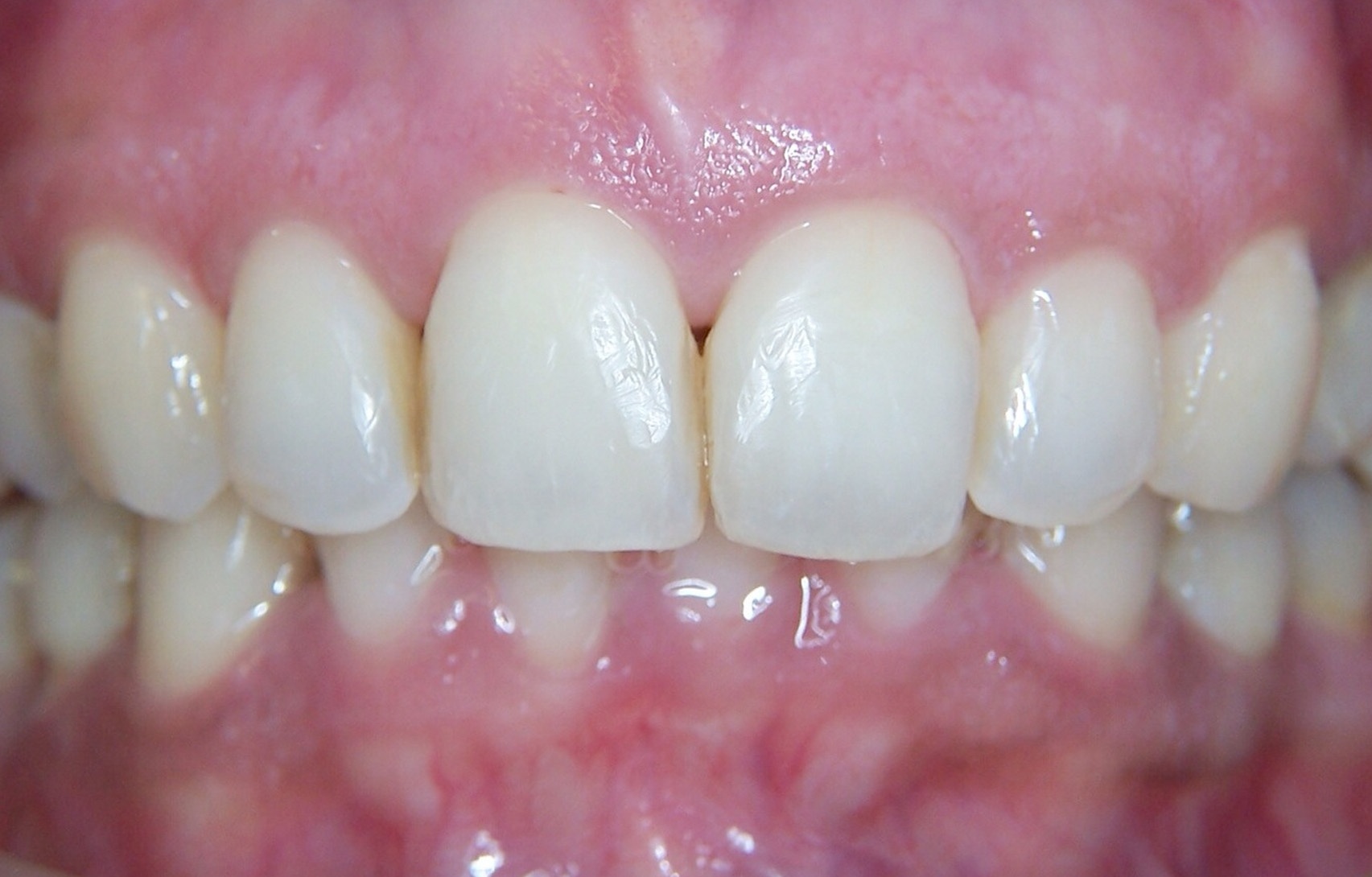 After image