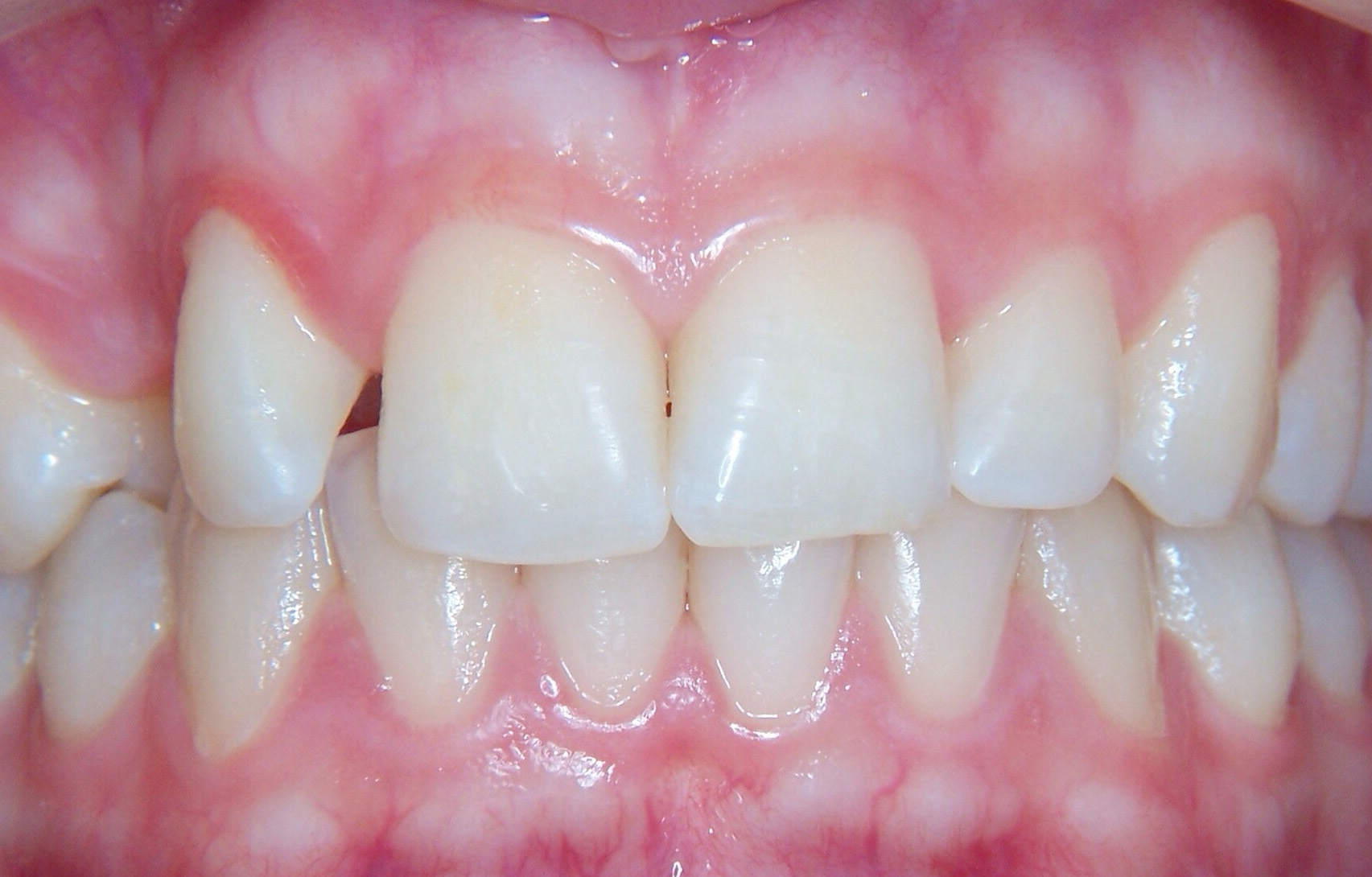 Before image
