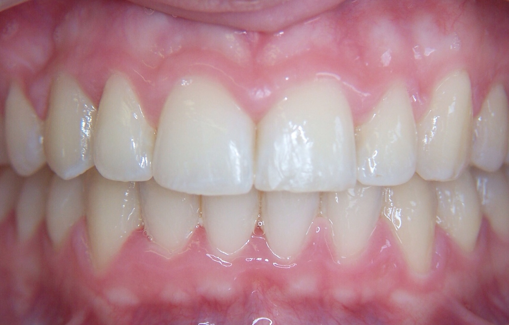 After image