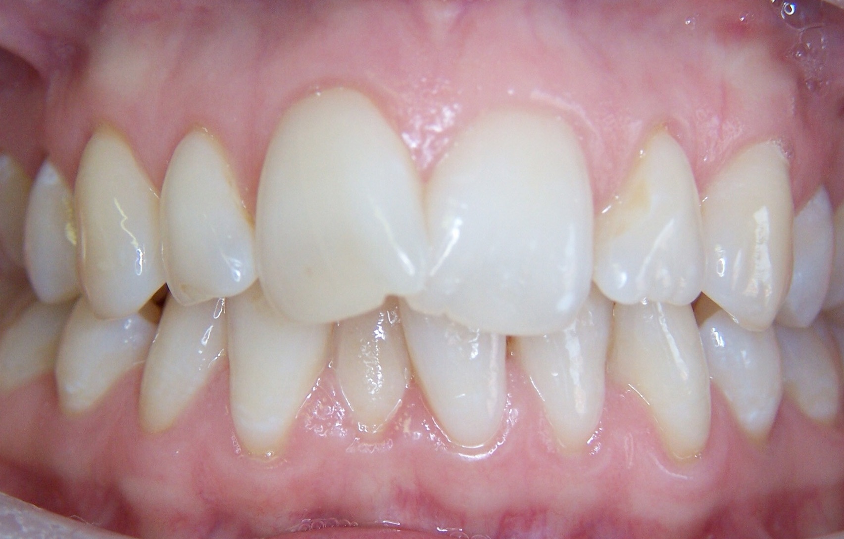 Before image
