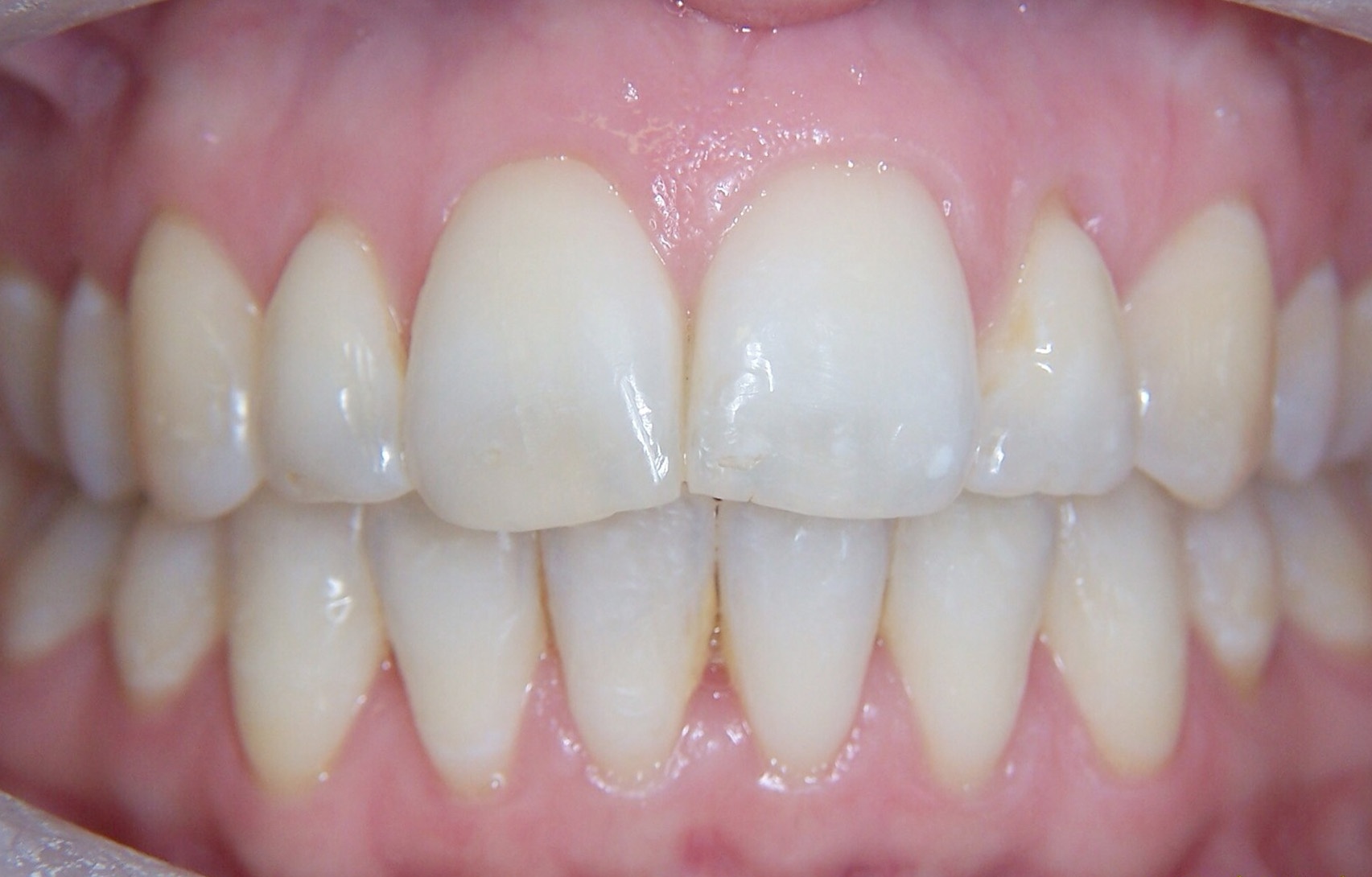 After image