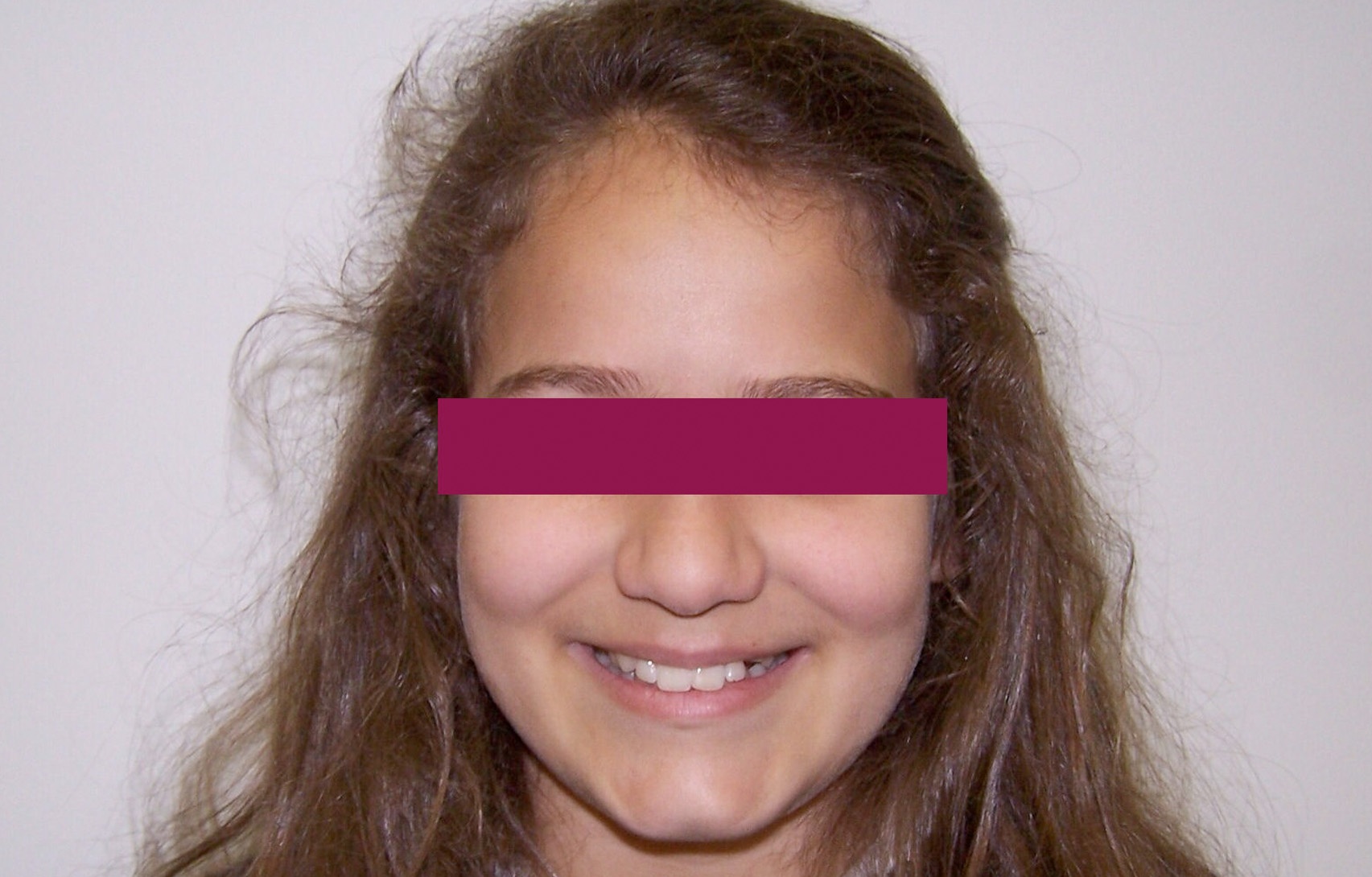 Before image