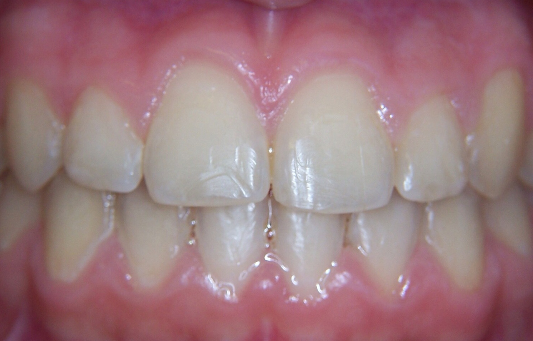 After image