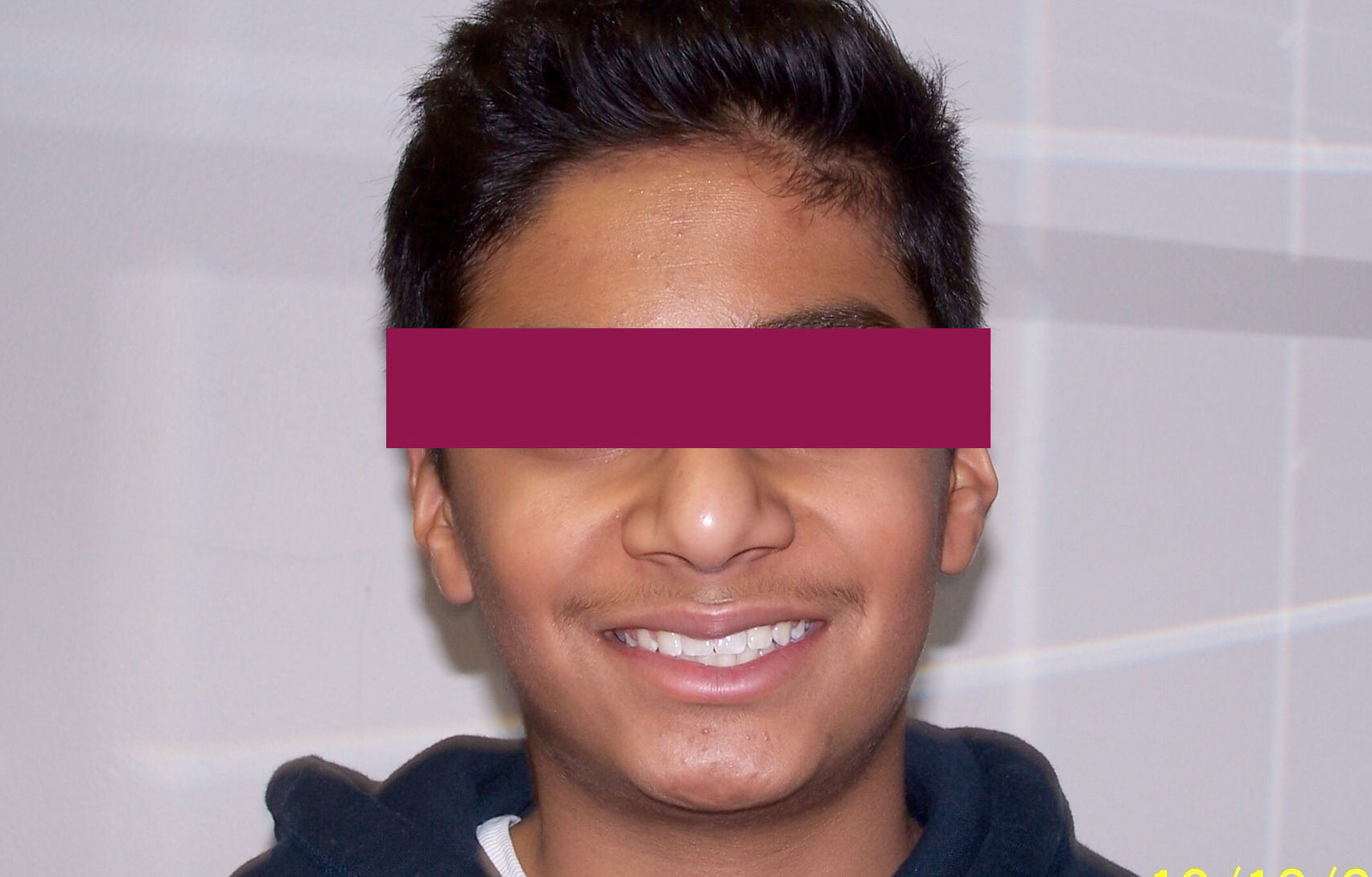 After image
