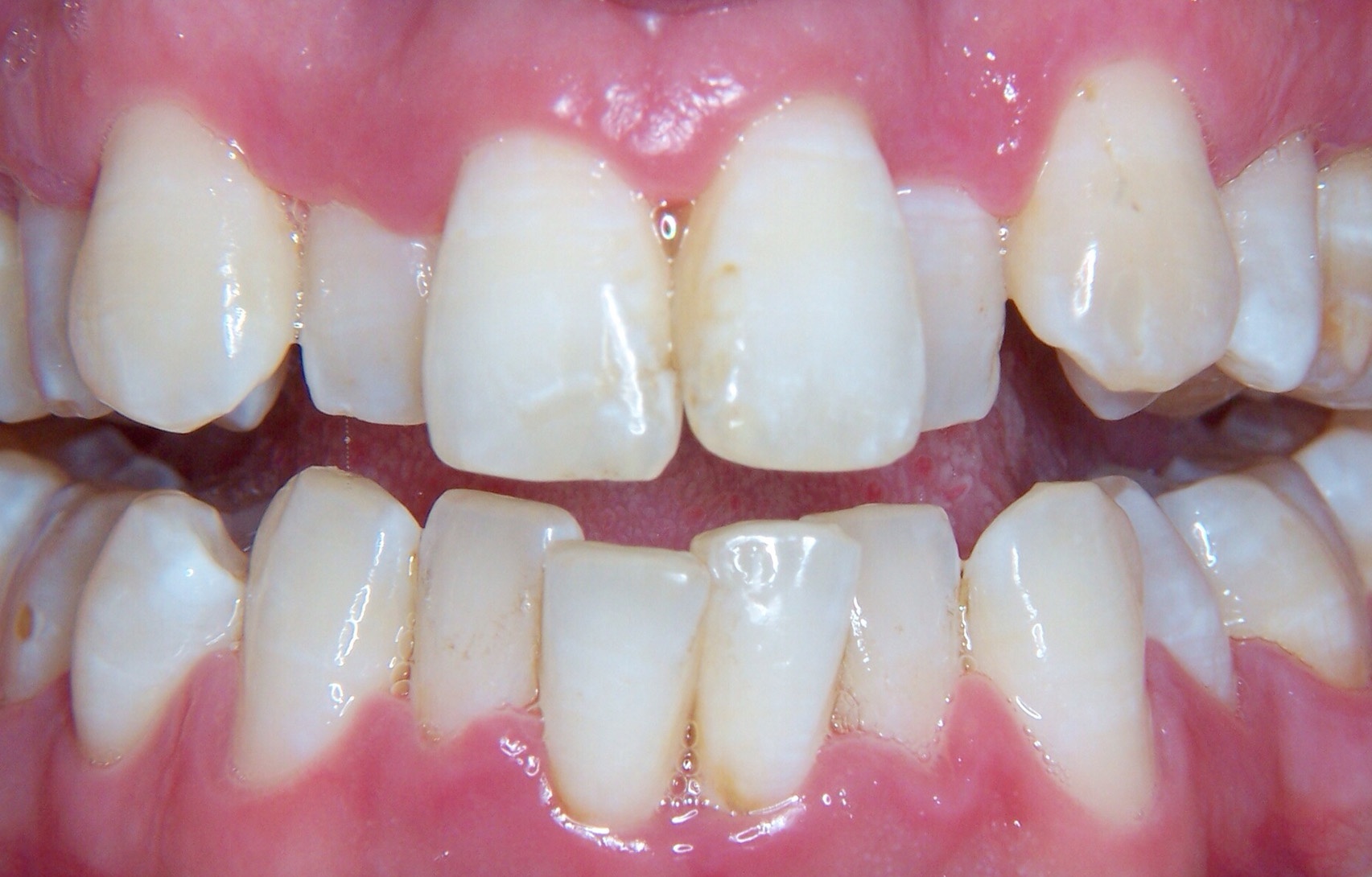 Before image