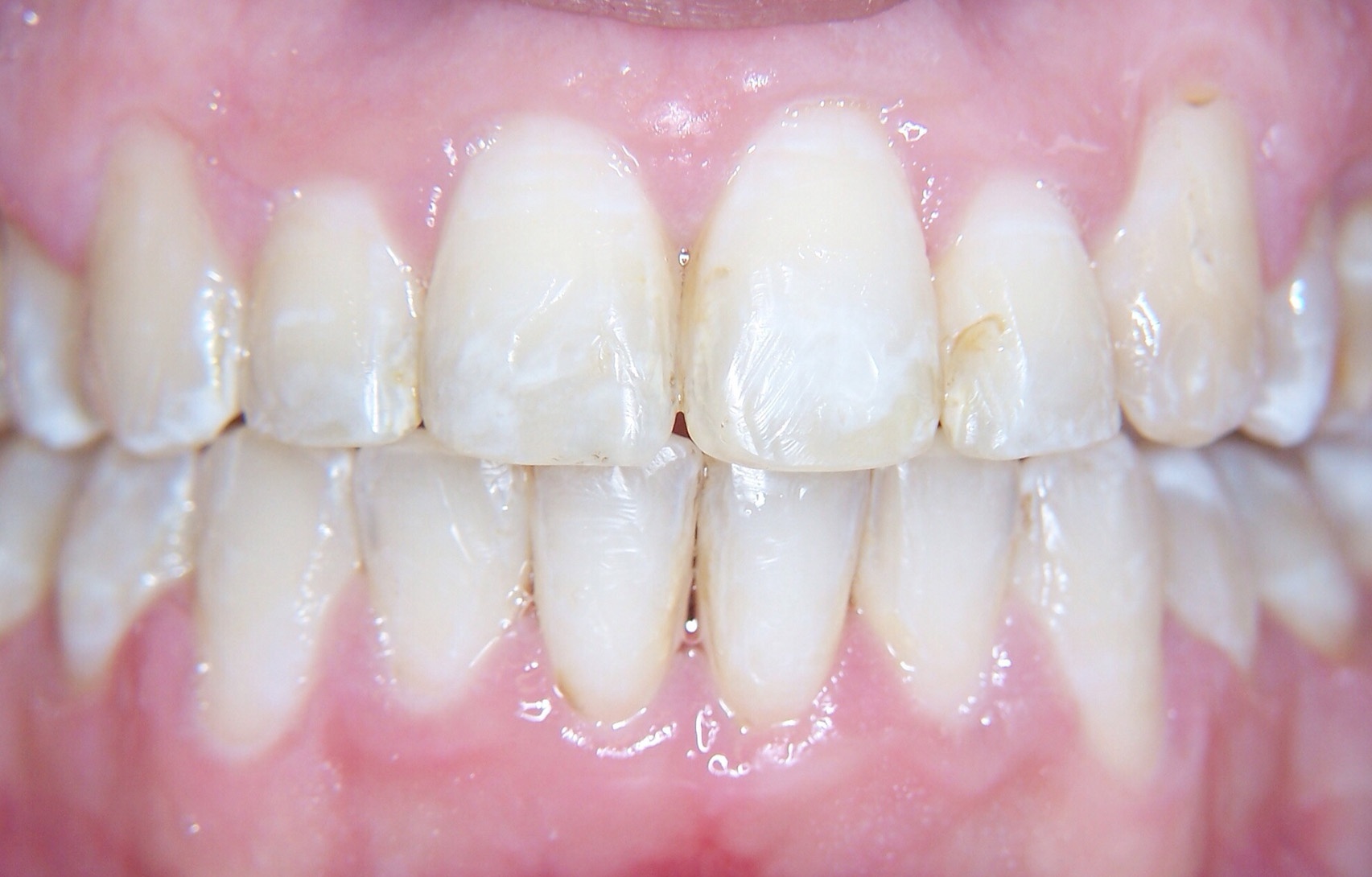 After image