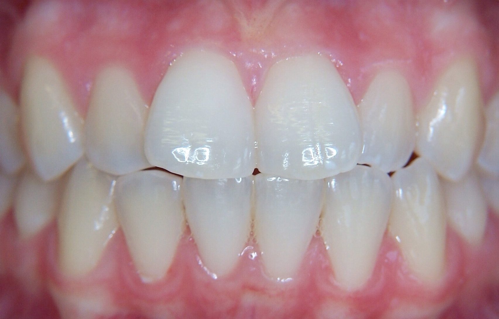 Before image