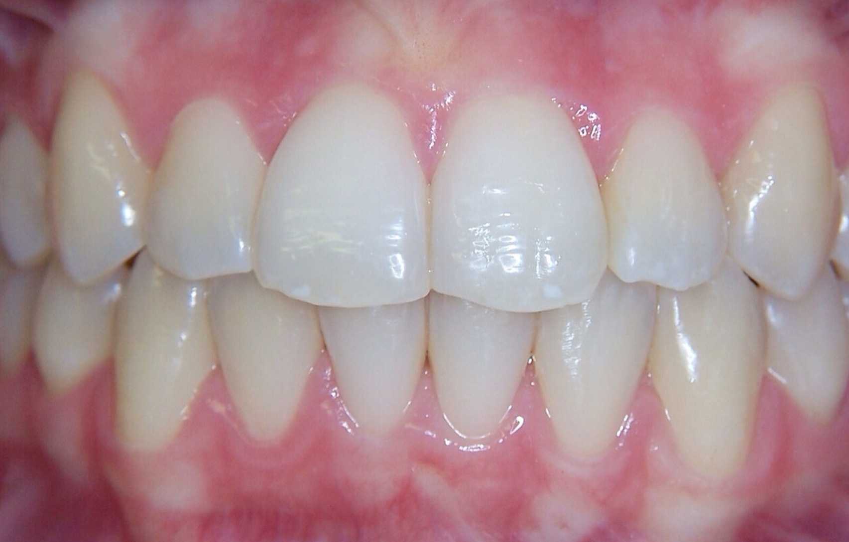 After image