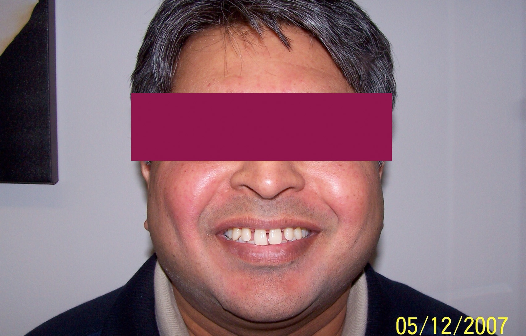 Before image