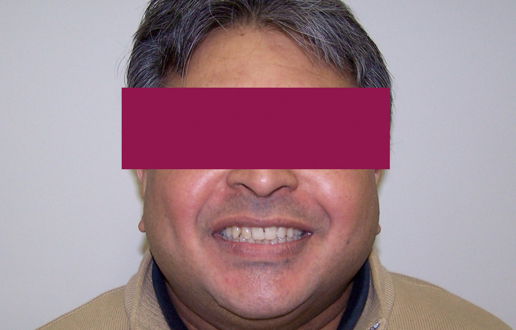 After image