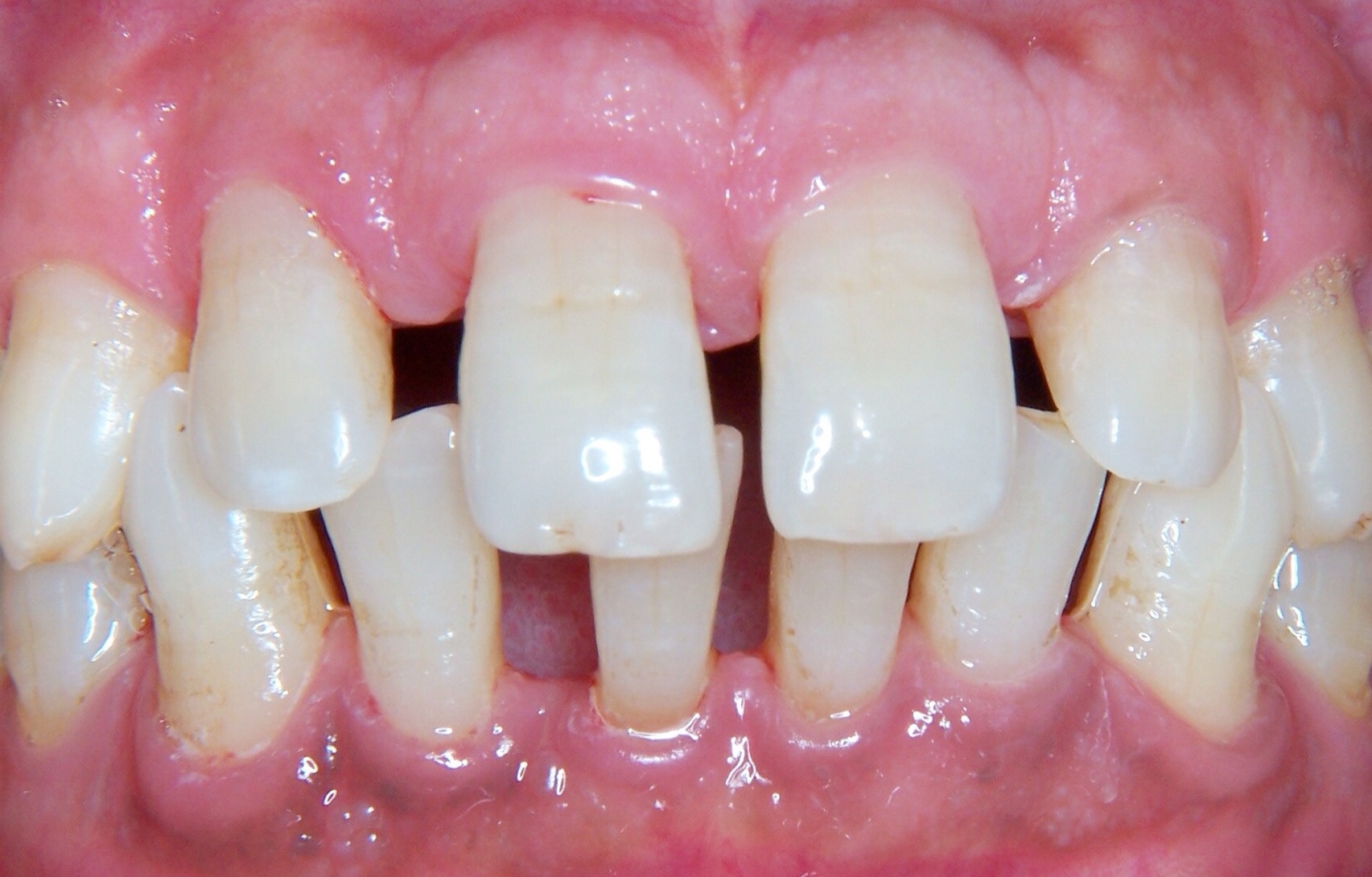 Before image