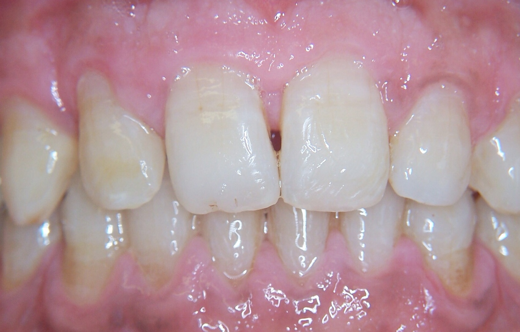 After image