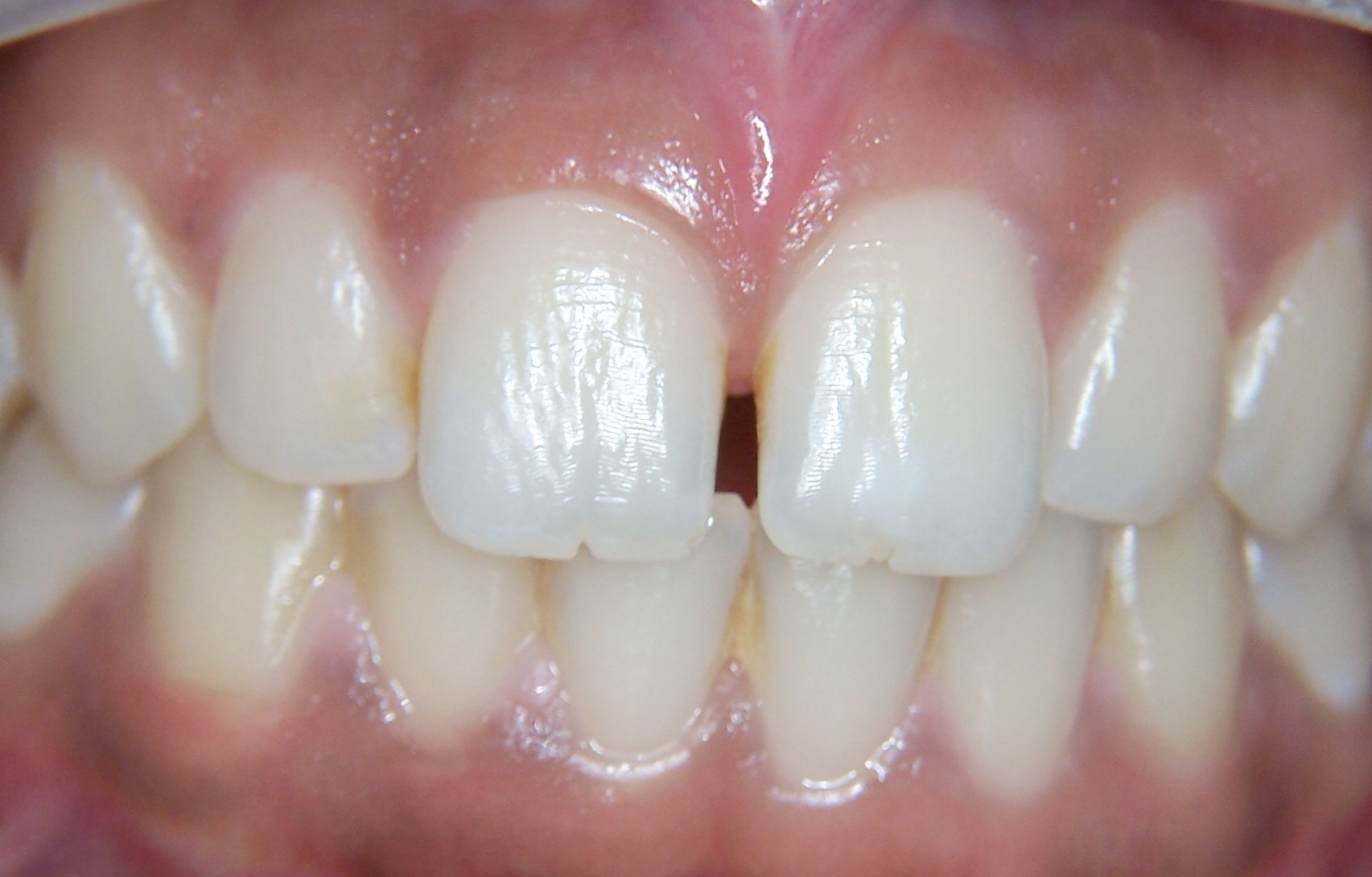 Before image