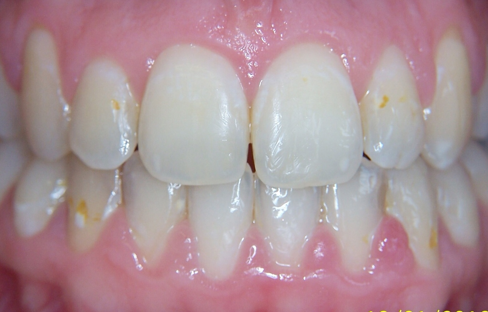 After image