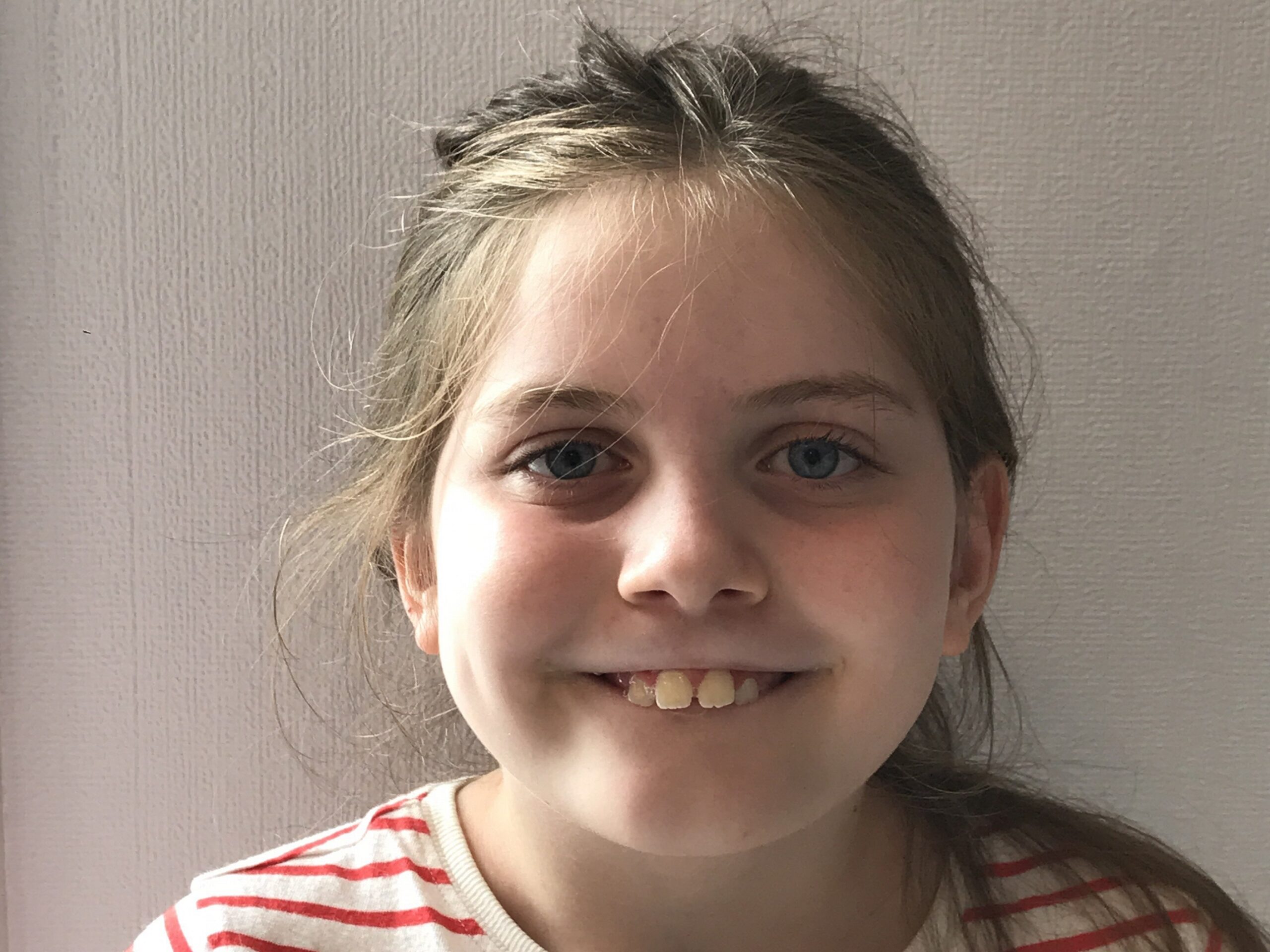 children's smile