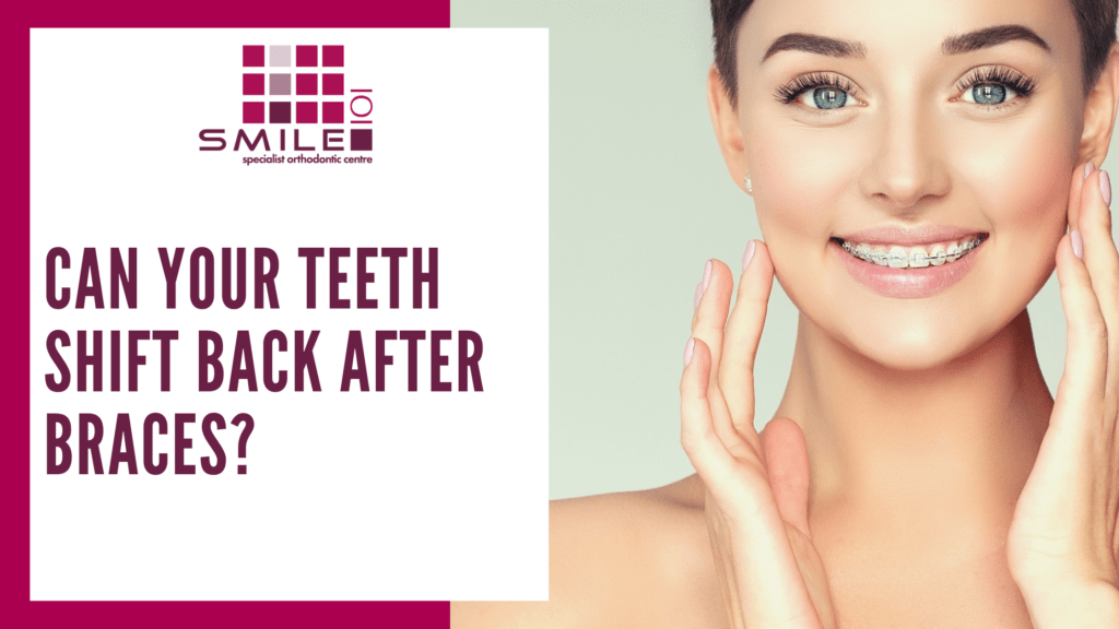 Can Your Teeth Shift Back After Braces? Smile 101 Specialist Orthodontics